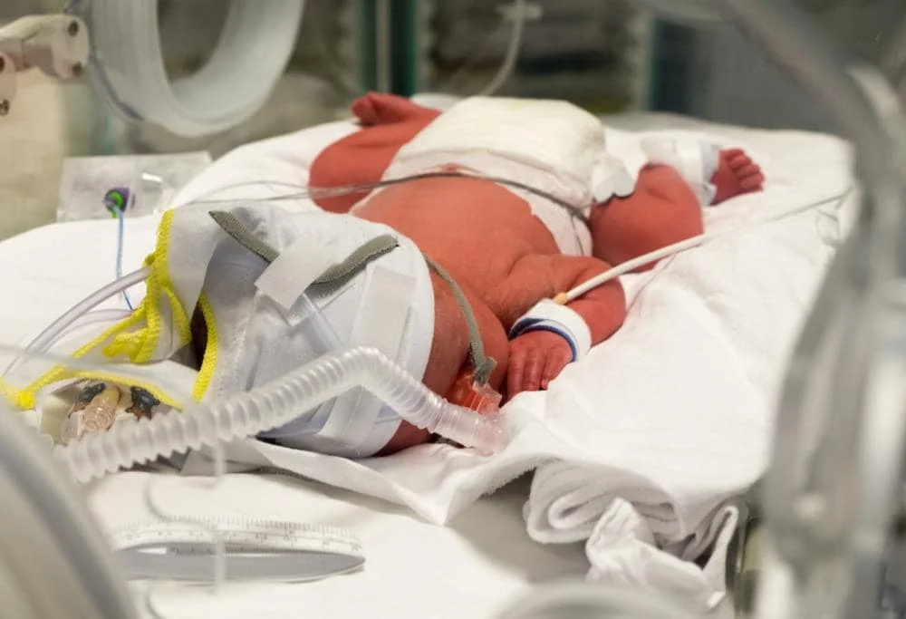 آمبولانس نوزاد در حال حمل کودک